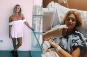 Из-за привычки грызть ногти у девушки развился редкий рак пальца