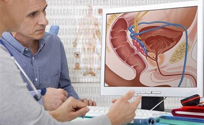 10 признаков рака предстательной железы, которые можно упустить