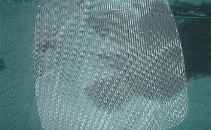 Не все сетчатые имплантаты для лечения грыж одинаково безопасны. Разбираемся